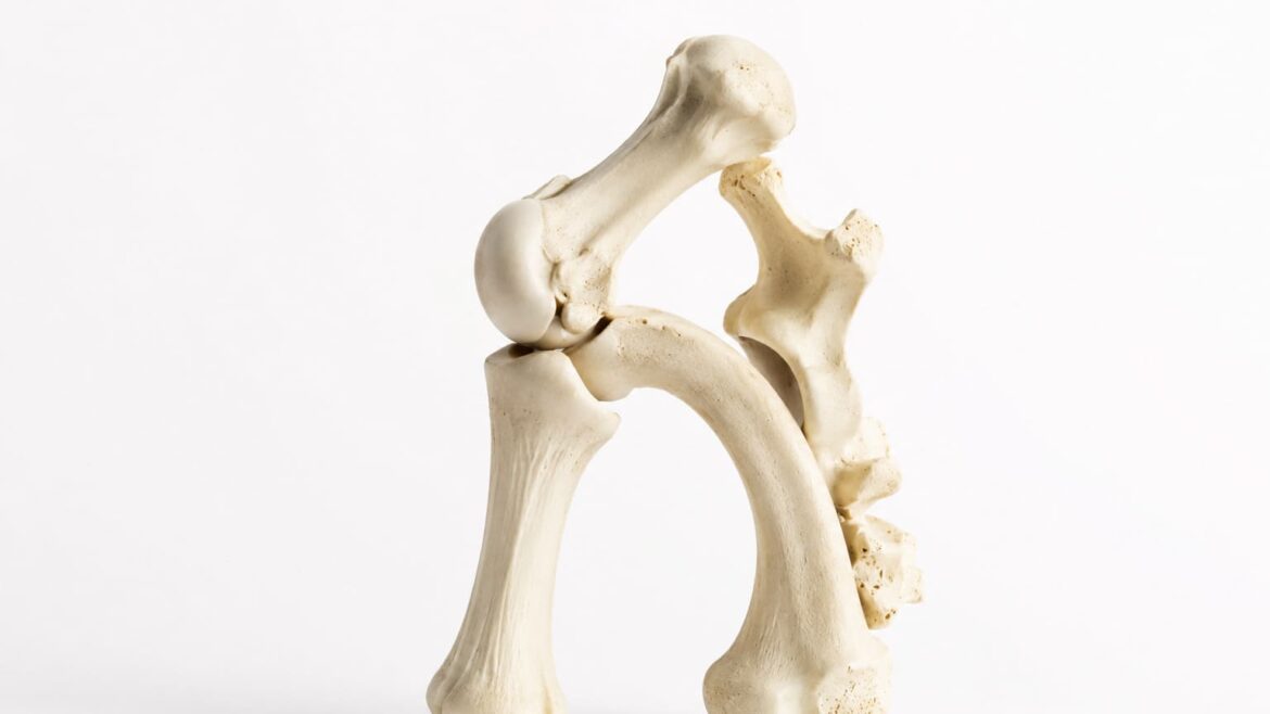 Osteointegración la clave del éxito de los implantes dentales(1)